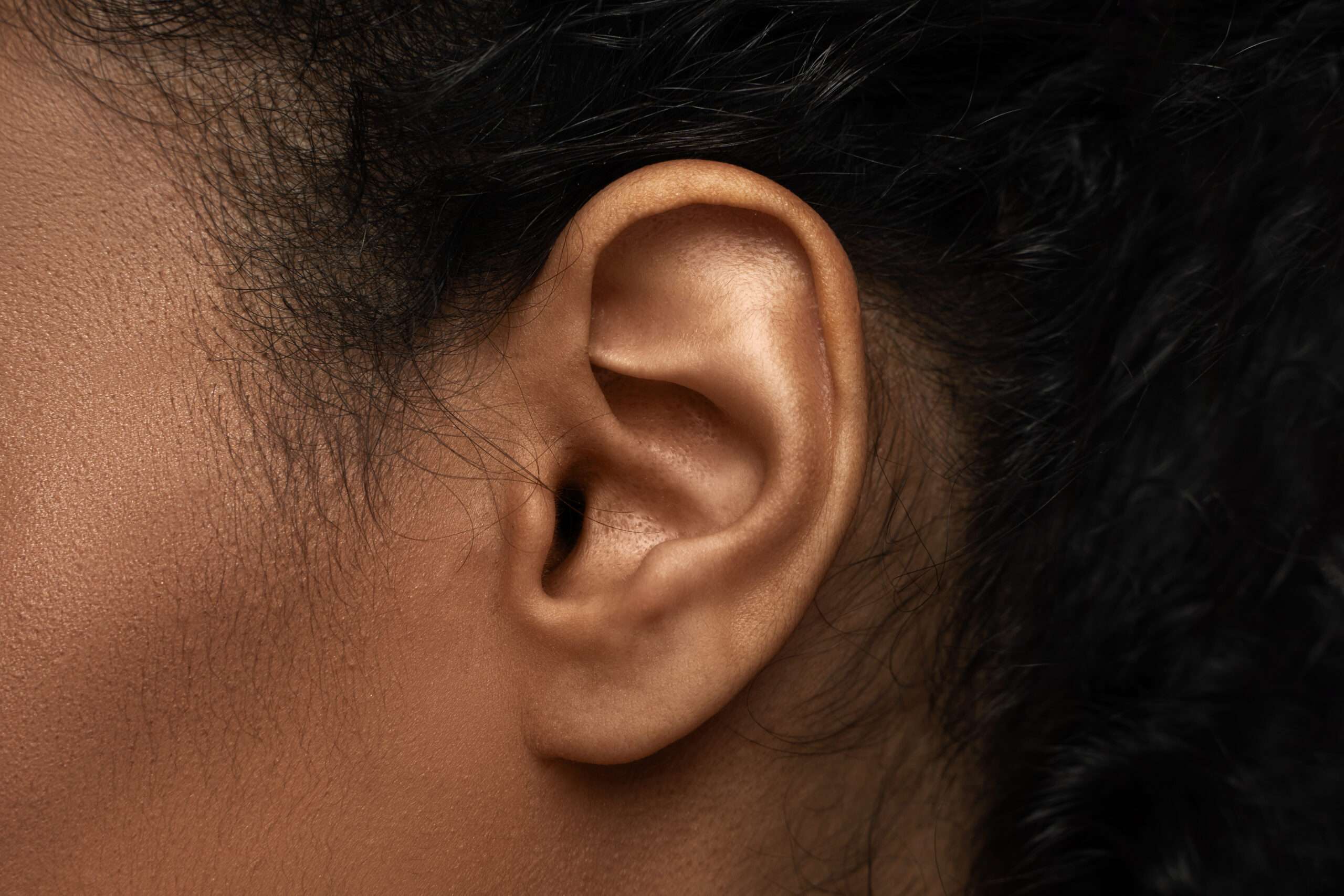 Aesthetic Ear Surgery in Beverly Hills | Alfred Cohen MD