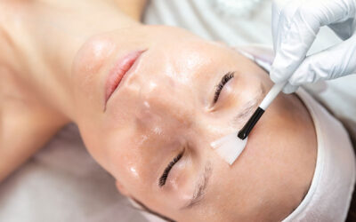 Facial Resurfacing: What Are the Options?