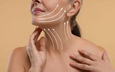 Combing a Facelift and Neck Lift in Beverly Hills